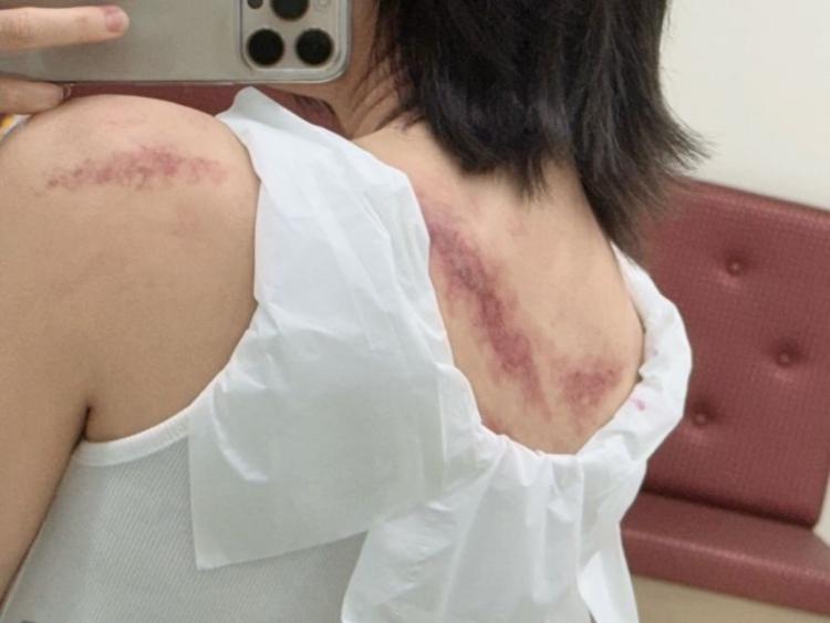 전소영 인별/ 이나영 정은채 이청아 아너5