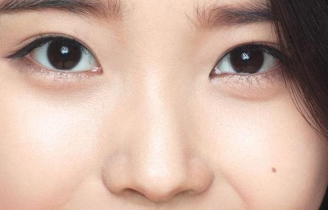 아이유
