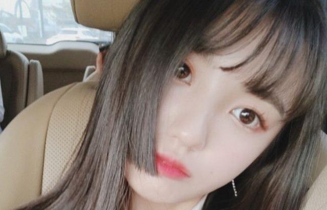 토끼앞니 쩌는 애