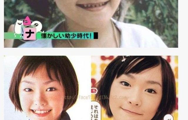 수술 전 아라가키 유이
