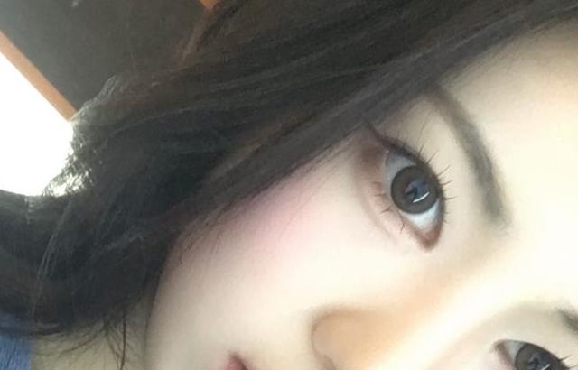 이프아이 미유